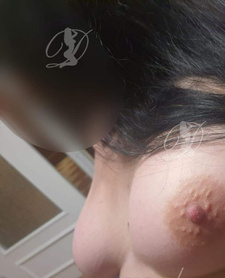 100Zł szybki numerek — Łańcut